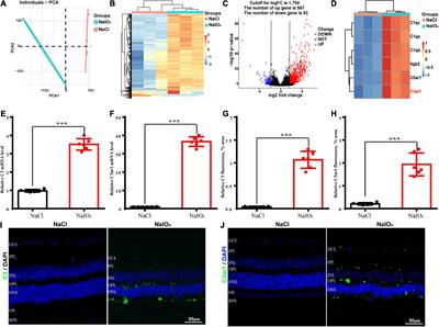 Complement C3a receptor inactivation attenuates retinal degeneration induced by oxidative damage